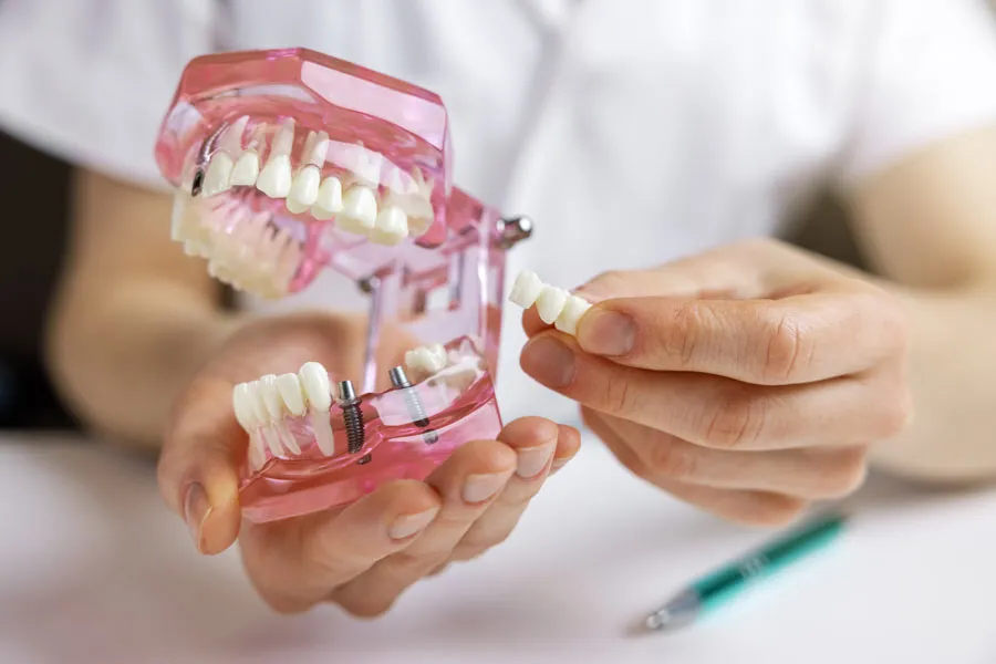 Zubní implantáty