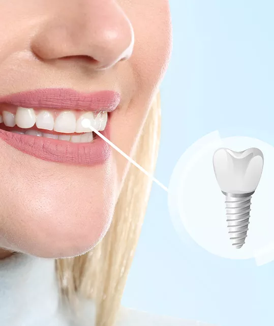 Zubní implantát